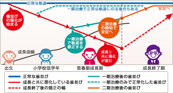 「ライフスタイルに合わせた」矯正治療を